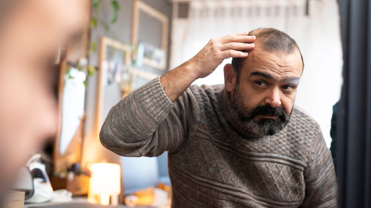 Hair loss treatments for balding are ‘new Botox’ today, researchers find