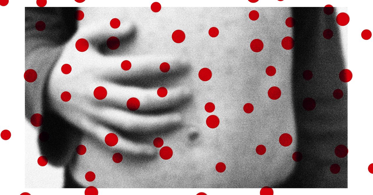Measles Cases Are Rising. Other Preventable Diseases Could Follow
