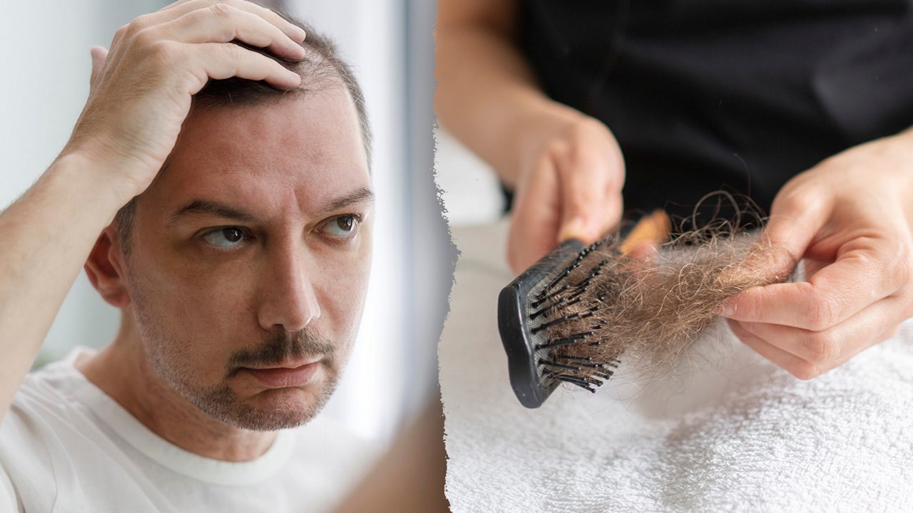Hair loss more likely with Ozempic, other semaglutide drugs, study suggests