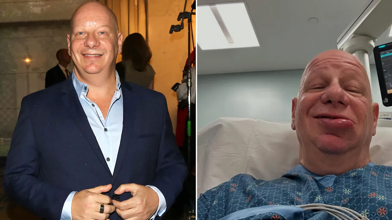 ‘Roastmaster General’ comedian Jeff Ross recovering from allergic reaction