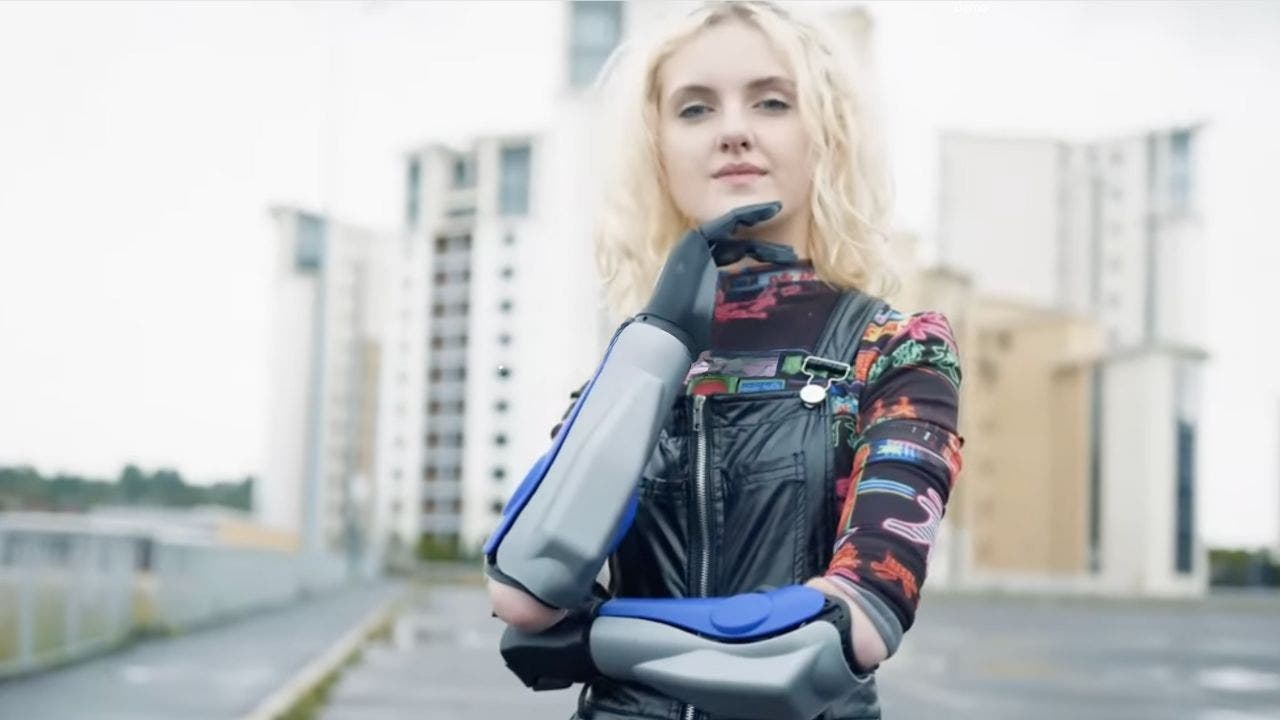 Wireless, waterproof bionic arm with 360-degree wrist rotation