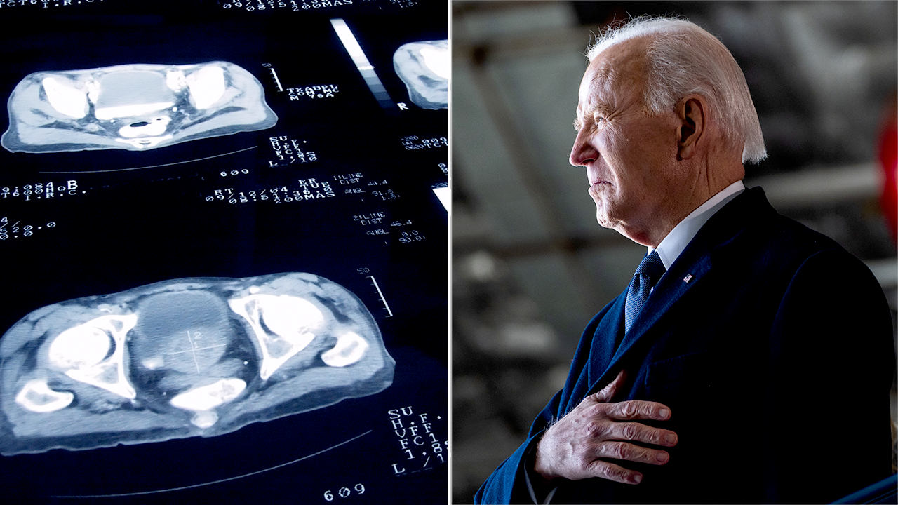 What Biden’s Gleason score of 9 means for ‘aggressive’ prostate cancer case