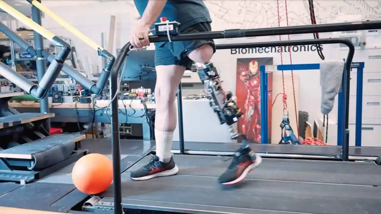 Bionic knee helps amputees walk naturally again