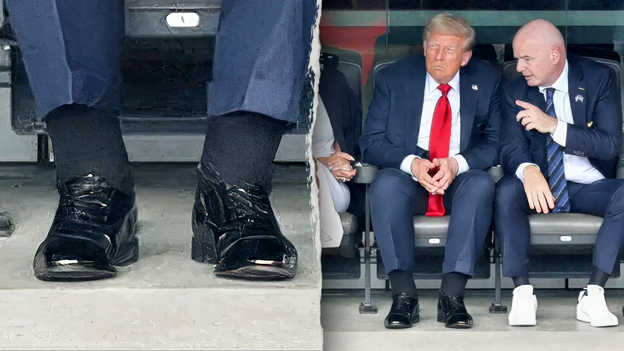 Doctors discuss Trump’s swollen legs and bruised hand after photos circulate