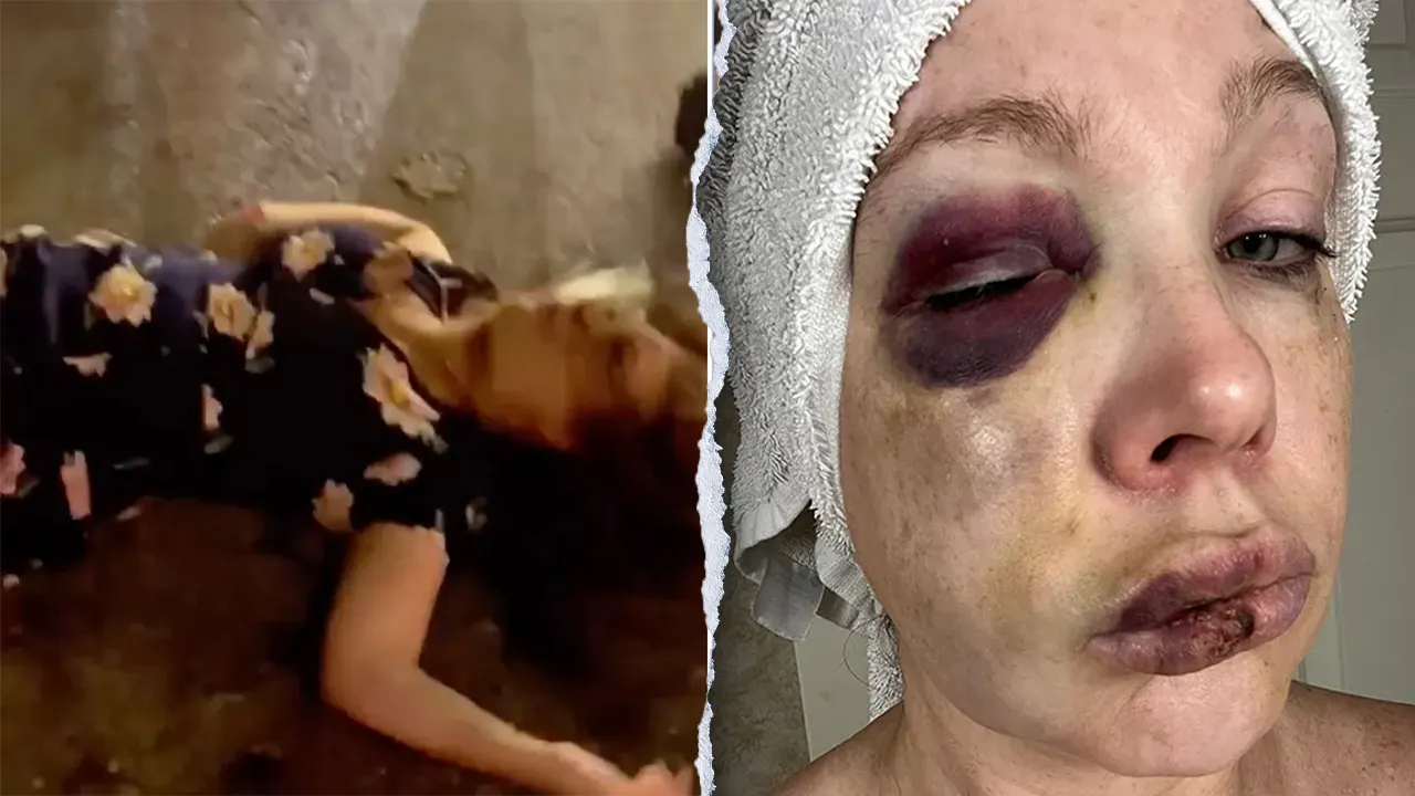 Victim of viral Cincinnati brawl reveals severe brain injuries and recovery