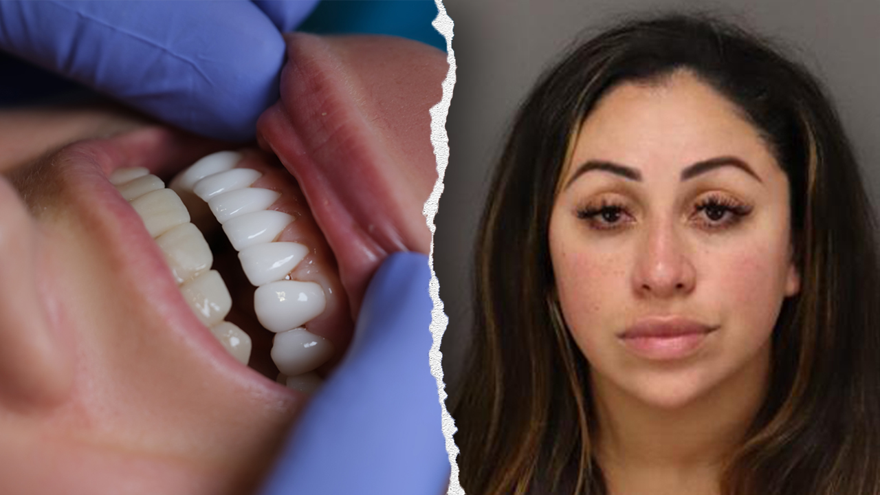 Florida woman charged with fraud for allegedly doing unlicensed dental work