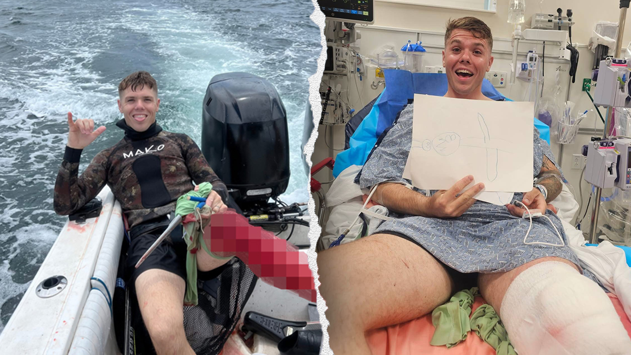 Florida spearfisherman survives bull shark bite, plans to return to water