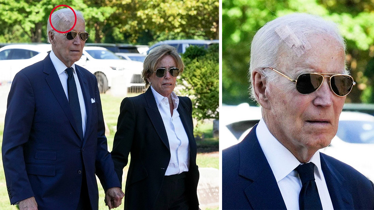 Biden seen with giant scar on head after skin cancer surgery