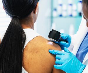 Vitamin B3 linked to lower skin cancer risk in new research findings
