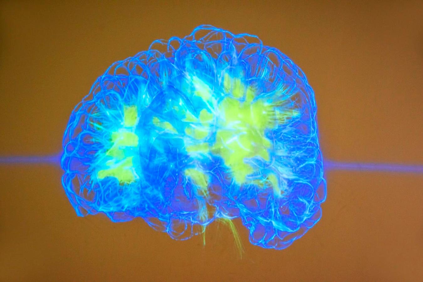 Can AI Learn And Evolve Like A Brain? Pathway’s Bold Research Thinks So