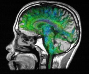 What Really Drives Hunger And Fullness: The Science Explained
