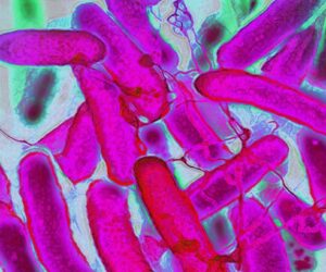 Resistant Bacteria Are Advancing Faster Than Antibiotics