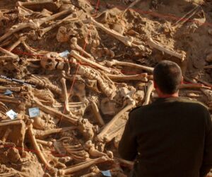 DNA reveals the diseases that devastated Napoleon’s doomed army
