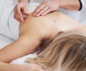 NIH study finds acupuncture reduces chronic back pain in older adults