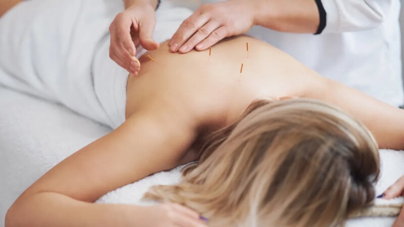 NIH study finds acupuncture reduces chronic back pain in older adults