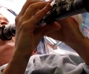 Parkinson’s patient plays clarinet during brain surgery