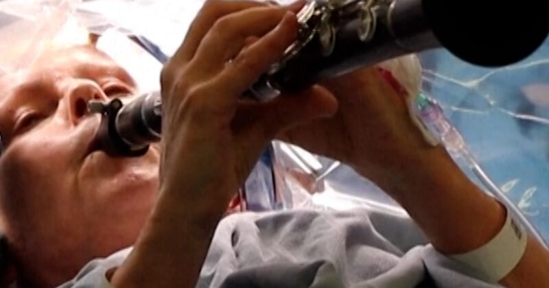 Parkinson’s patient plays clarinet during brain surgery