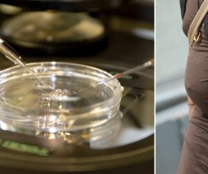 Scientists create human eggs from skin cells in fertility breakthrough