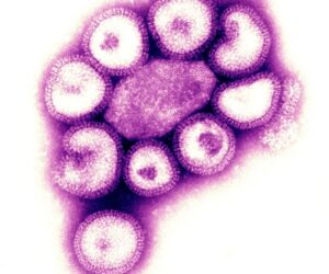 A New More Severe Flu Variant Is Spreading In The U.S. Here’s What To Know