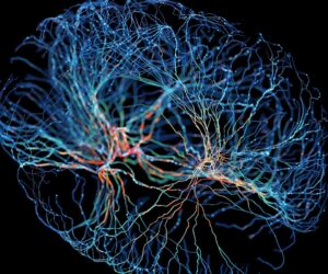 Two Alzheimer’s Trial Failures Reveal Clinical Challenges