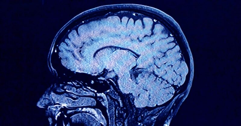 Human brains have 5 distinct ‘epochs’ in a lifetime, study finds