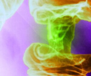 A New Light-Based Cancer Treatment Kills Tumor Cells and Spares Healthy Ones