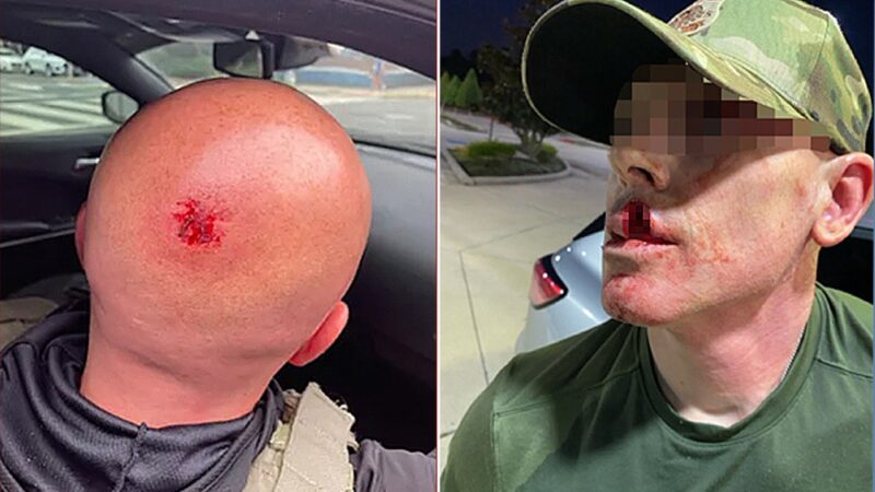 ICE officer assaults surge 1,150% under Trump admin, DHS reports