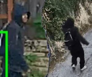 88-year-old woman hospitalized after finger bitten off in robbery: police